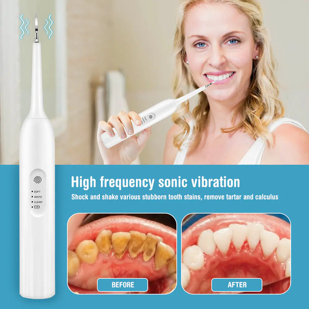 Smart Touch Screen Tooth Cleaner for Home Use