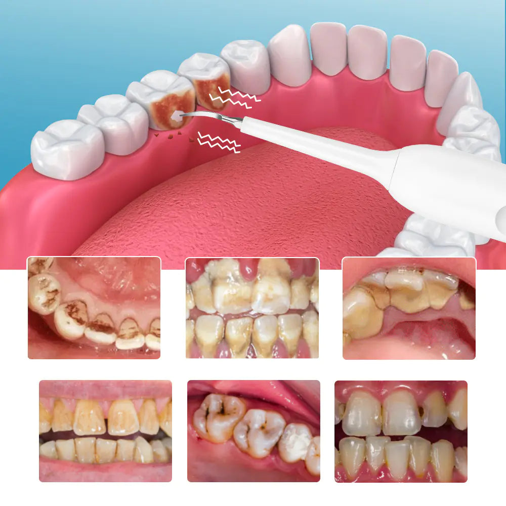 Smart Touch Screen Tooth Cleaner for Home Use